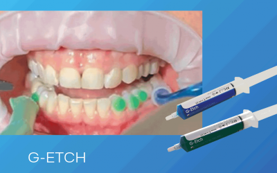 G-ETCH : New Formula