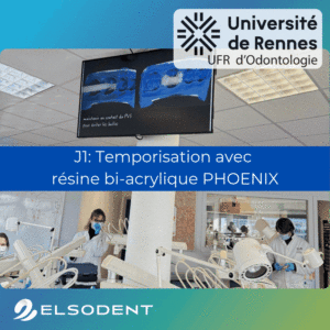 TP temporisation resine bi-acrylique PHOENIX & PHOENIX MD