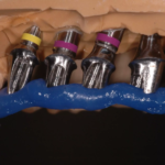 10. RIM Check on Implant Abutments 4