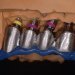 16. RIM check and adaptation of supra-implant framework 4