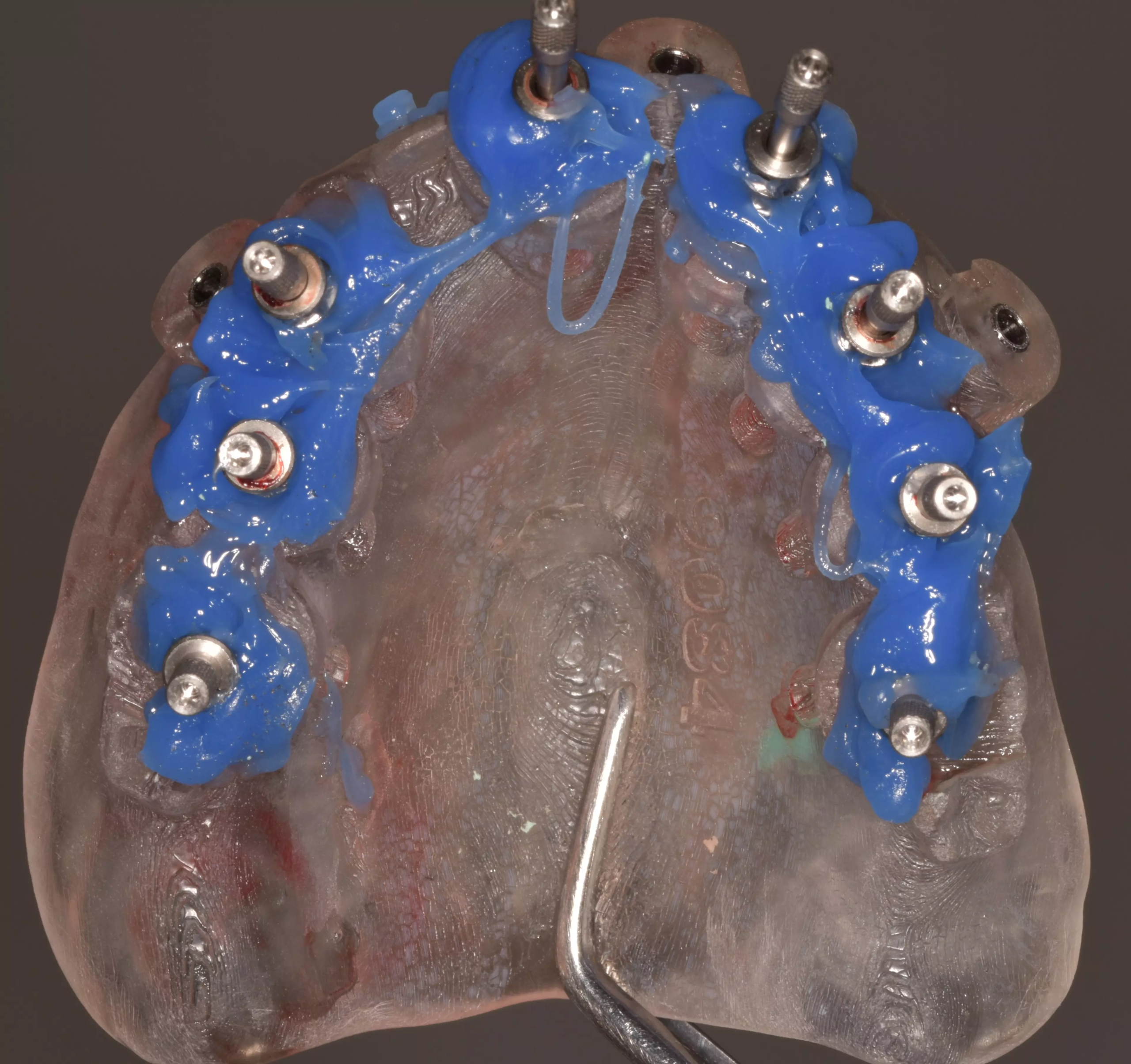 Elsodent - DUROC Clinical Case #2