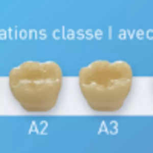 CL PURESHADE2exemplesclass1-1-600x600
